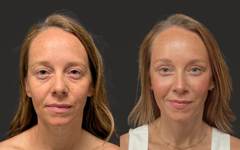 HomeB&A 2 HomeBA 2